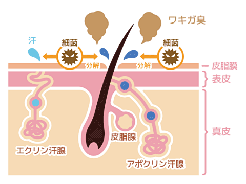 ワキガの直接的な原因はアポクリン腺