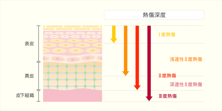 熱傷深度